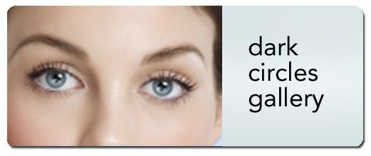 Best Facelift, Midface Lift, Breast Augmentation, Cosmetic & Plastic Surgery | Surgical Correction of Dark Circles image 6